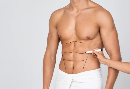 Abdominal 6 Pack Surgery in Navi Mumbai