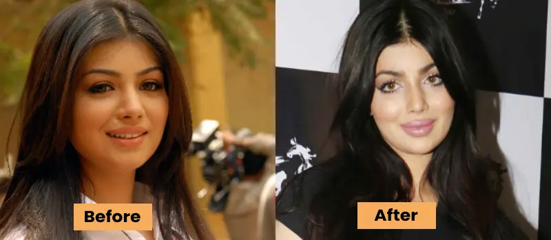 The Transformation of Ayesha Takia