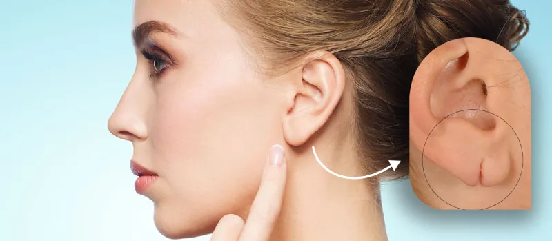 Ear Lobe Repair: Everything You Need to Know