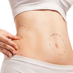 Liposuction & Lipofilling