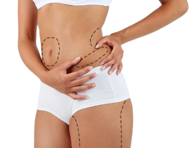 Liposuction Treatment in Navi Mumbai